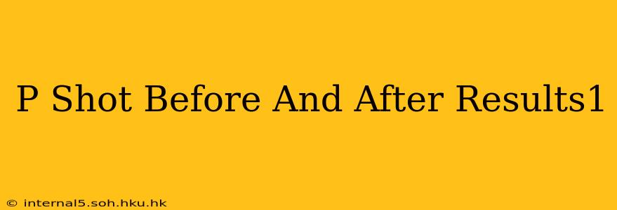 P Shot Before And After Results1